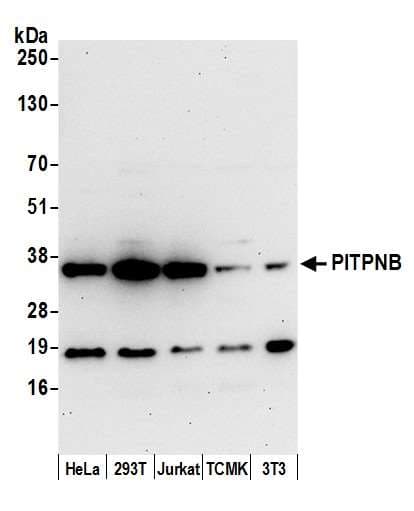 PITPNB Antibody (aa221-271)