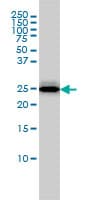 RGS2 Antibody (clone 4C4)