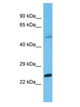 PRSS45 Antibody (aa166-215)