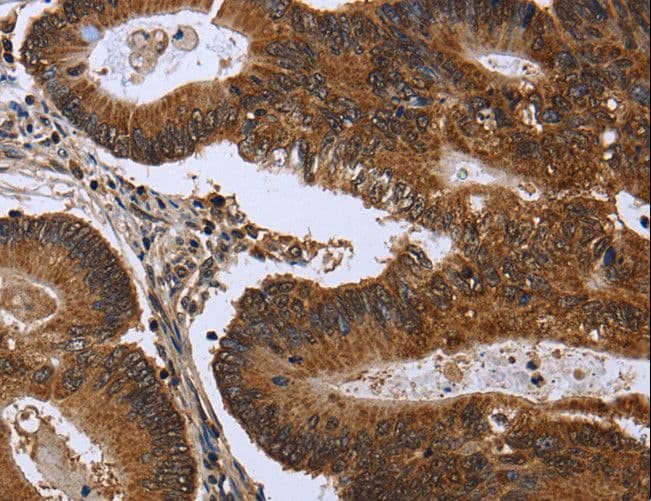Polyclonal Rabbit anti-Human FGFR1OP / FOP Antibody (IHC)
