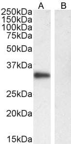 IHC-plus™ CD20 Antibody (aa284-297)