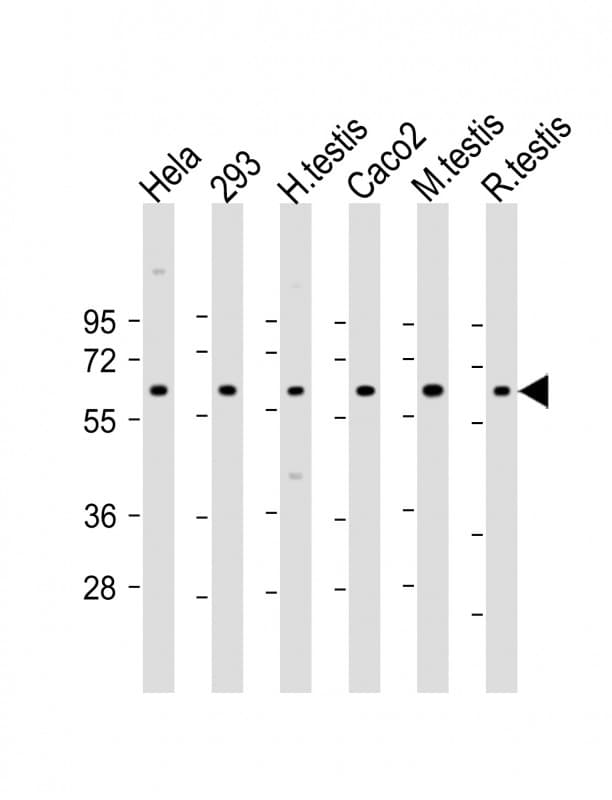SLC2A8 / GLUT8 Antibody (Internal)