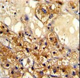 Polyclonal Rabbit anti-Human CYP-M / CYP20A1 Antibody (aa364-392, IHC, WB)
