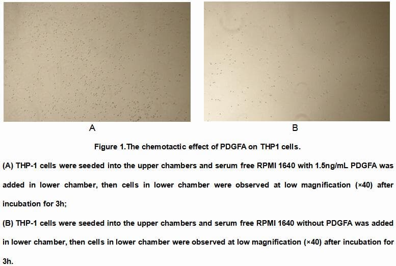 Rat Chymotrypsin C Protein (Recombinant His, N-Terminal)