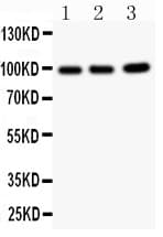 Polyclonal Rabbit anti-Human EPB41L1 / 4.1N Antibody (aa691-881, WB)