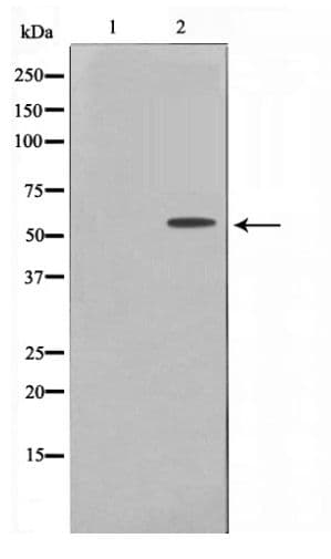 SYN / FYN Antibody (phospho-Tyr530)