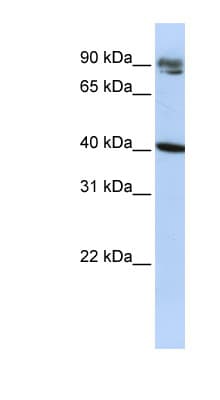 Polyclonal Rabbit anti-Human KLHDC8A Antibody (C-Terminus, WB)