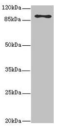 Polyclonal Rabbit anti-Human FTHFSDC1 / MTHFD1L Antibody (IHC, WB)
