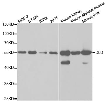 DLD / Diaphorase / E3 Antibody