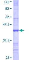 Human NDST3 Protein (Recombinant GST, N-terminus)