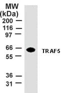 IHC-plus™ TRAF5 Antibody (aa77-186, clone 55A219)