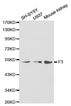 F3 / CD142 / Tissue factor Antibody