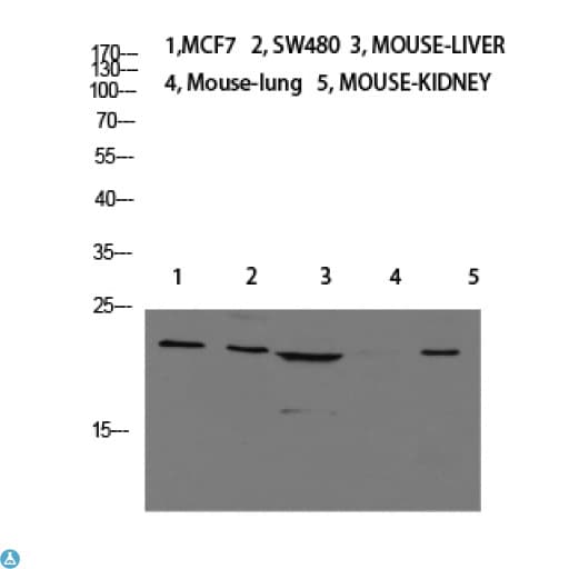 Calcitonin Antibody