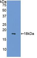 SST / Somatostatin Antibody (aa27-116)
