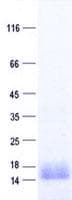 Human AP4S1 Protein (Recombinant His, N-Terminal)