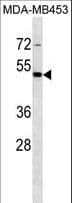 STAC Antibody (aa279-305)