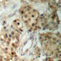 RPS6KA5 / MSK1 Antibody (Internal)