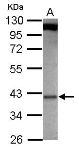 IHC-plus™ Polyclonal Rabbit anti-Human MLST8 / GBL Antibody (IHC, WB)