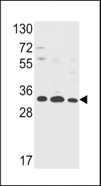 ANXA5 / Annexin V Antibody (aa1-30)
