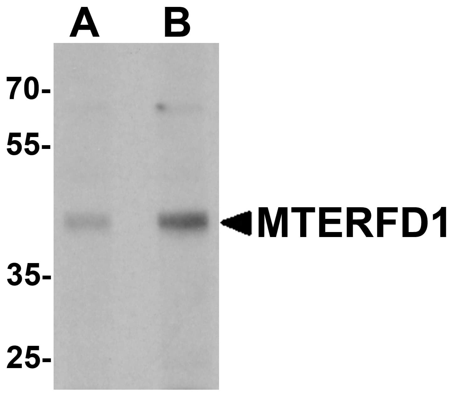 IHC-plus™ Polyclonal Rabbit anti-Human MTERF3 / MTERFD1 Antibody (IHC, IF, WB)