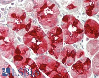 Polyclonal Rabbit anti-Human MUC6 / MUC-6 Antibody (aa2338-2439, IHC, WB)