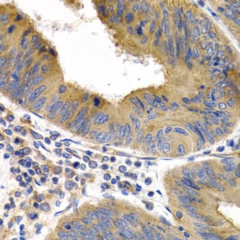 Polyclonal Rabbit anti-Human HSPB8 / H11 / HSP22 Antibody (IHC, IF, WB)