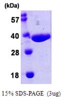 E. coli nanA Protein (Recombinant His)