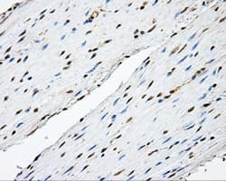 TPMT Antibody (clone OTI4B1)