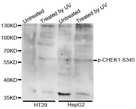 CHEK1 / CHK1 Antibody (phospho-Ser345)