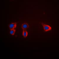 NTRK2 / TRKB Antibody (Internal)