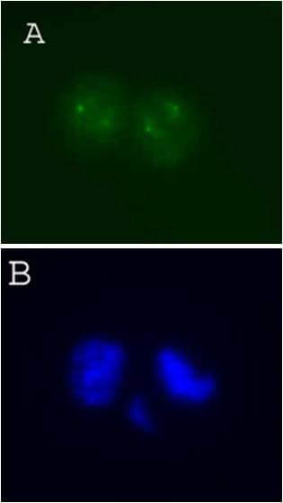 IHC-plus™ AURKA / Aurora-A Antibody (clone 7A3)