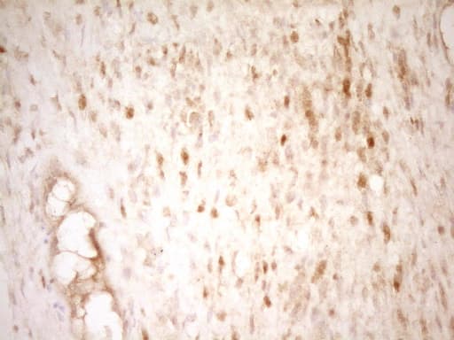 THRA / THR Alpha Antibody (aa1-220, clone OTI2A2)