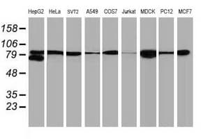 CTNNB1 / Beta Catenin Antibody (clone UMAB14, Carrier-free)