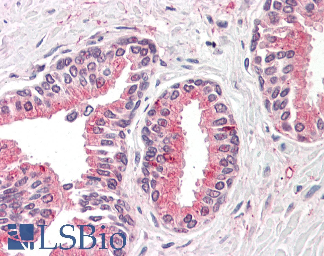 IHC-plus™ OLFM4 / Olfactomedin 4 Antibody (Internal)