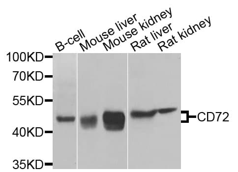 Polyclonal Rabbit anti-Human CD72 Antibody (WB)