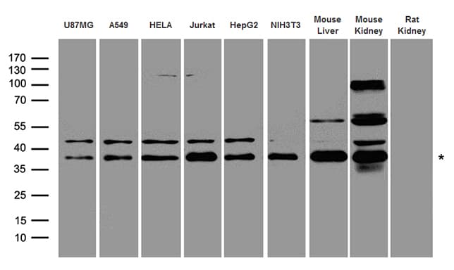 Polyclonal Rabbit anti-Human PRKAB1 / AMPK Beta 1 Antibody (WB)