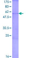 Human CDCA8 / Borealin Protein (Recombinant GST)