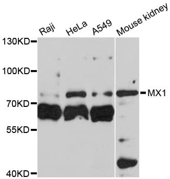 MX1 / MX Antibody