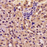 Polyclonal Rabbit anti-Human GOT2 Antibody (IHC, WB)