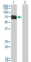 RTN2 / Reticulon 2 Antibody (clone 6A11)