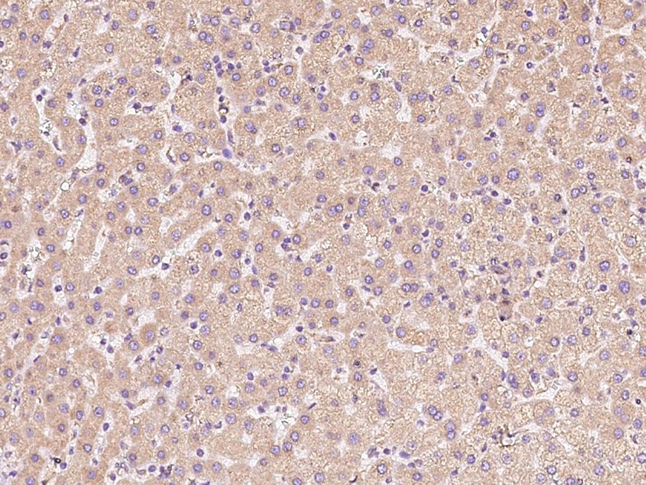 Polyclonal Rabbit anti-Human CALR / Calreticulin Antibody (IHC)