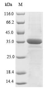 Human XRCC5 / Ku80 Protein (Recombinant 10His, N-terminus + Myc, C-terminus)