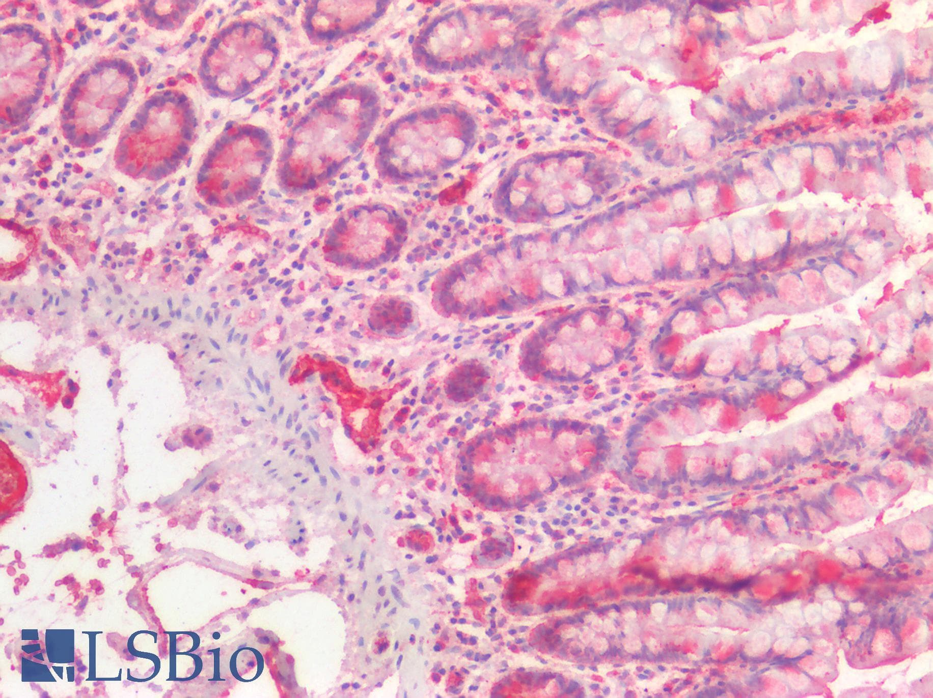 IHC-plus™ VWF / Von Willebrand Factor Antibody