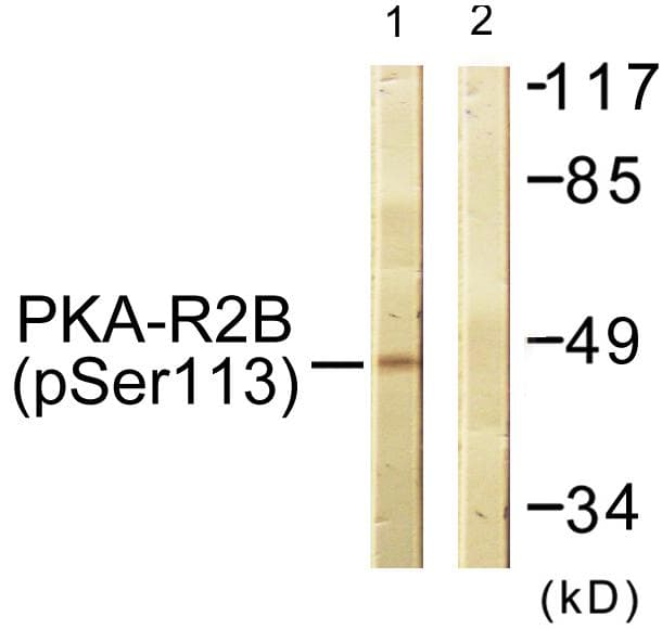 Polyclonal Rabbit anti-Human PRKAR2B Antibody (phospho-Ser113, WB)