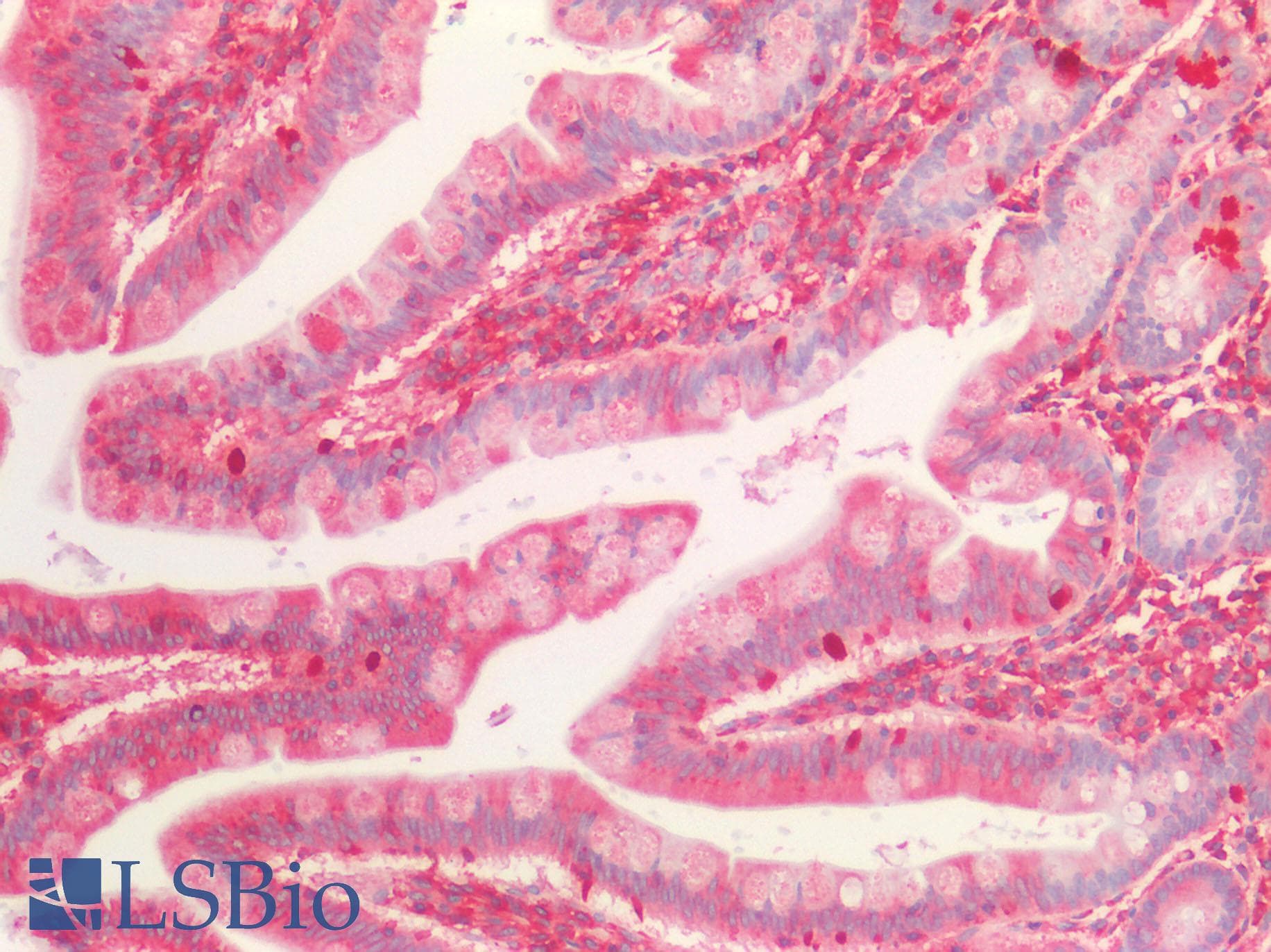 ROR2 Antibody
