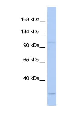 NARG1 / NAA15 Antibody (aa143-192)