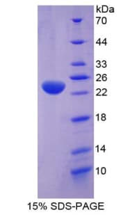 Human TEK / TIE2 Protein (Recombinant His-T7)