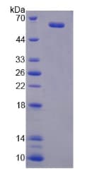 Human PGIS / PTGIS Protein (Recombinant His-T7)