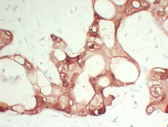 S100A6 / Calcyclin Antibody (clone ABT-S100A6)