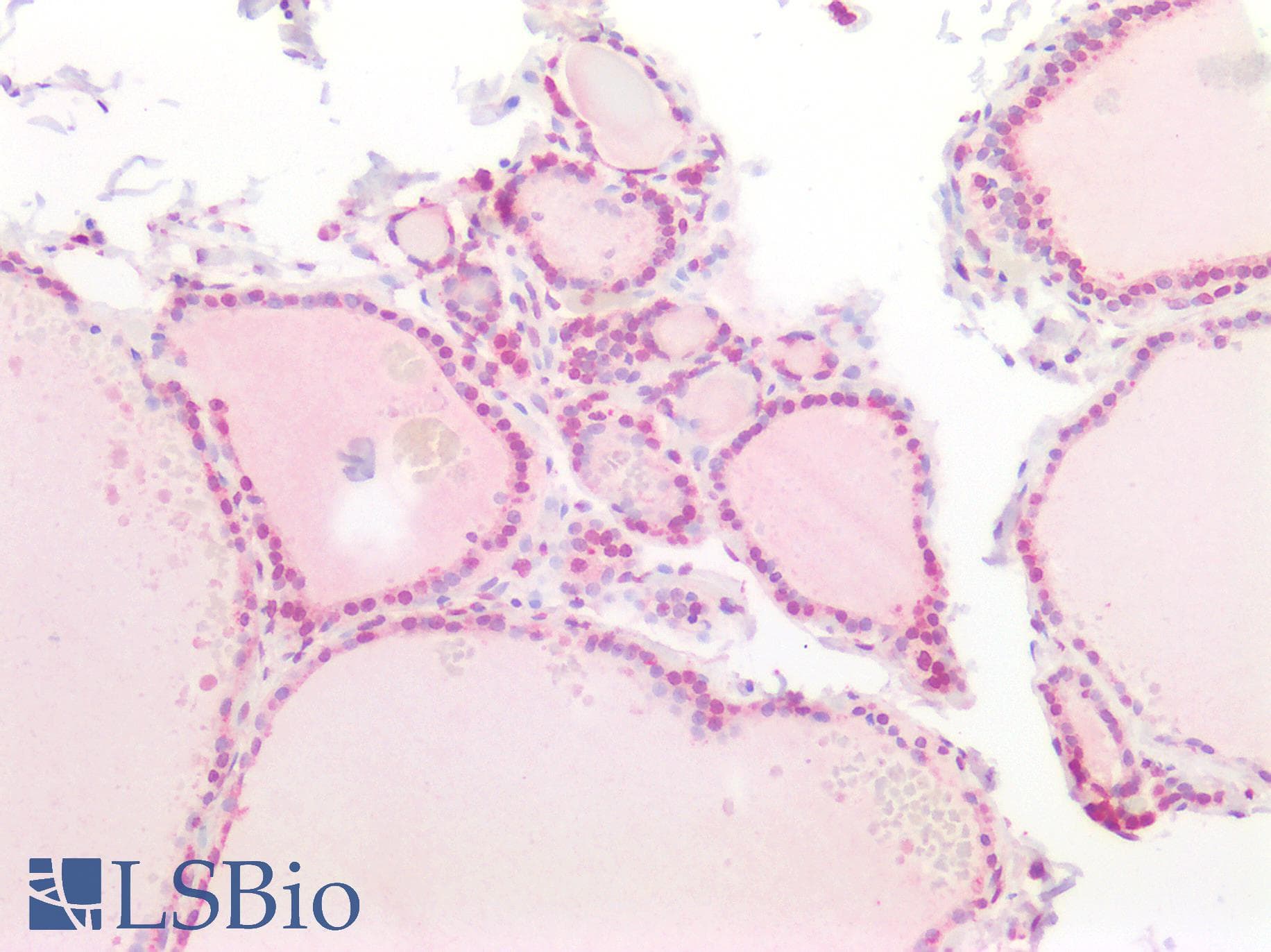 IHC-plus™ Polyclonal Rabbit anti-Human TSHZ1 Antibody (aa656-685, IHC, WB)